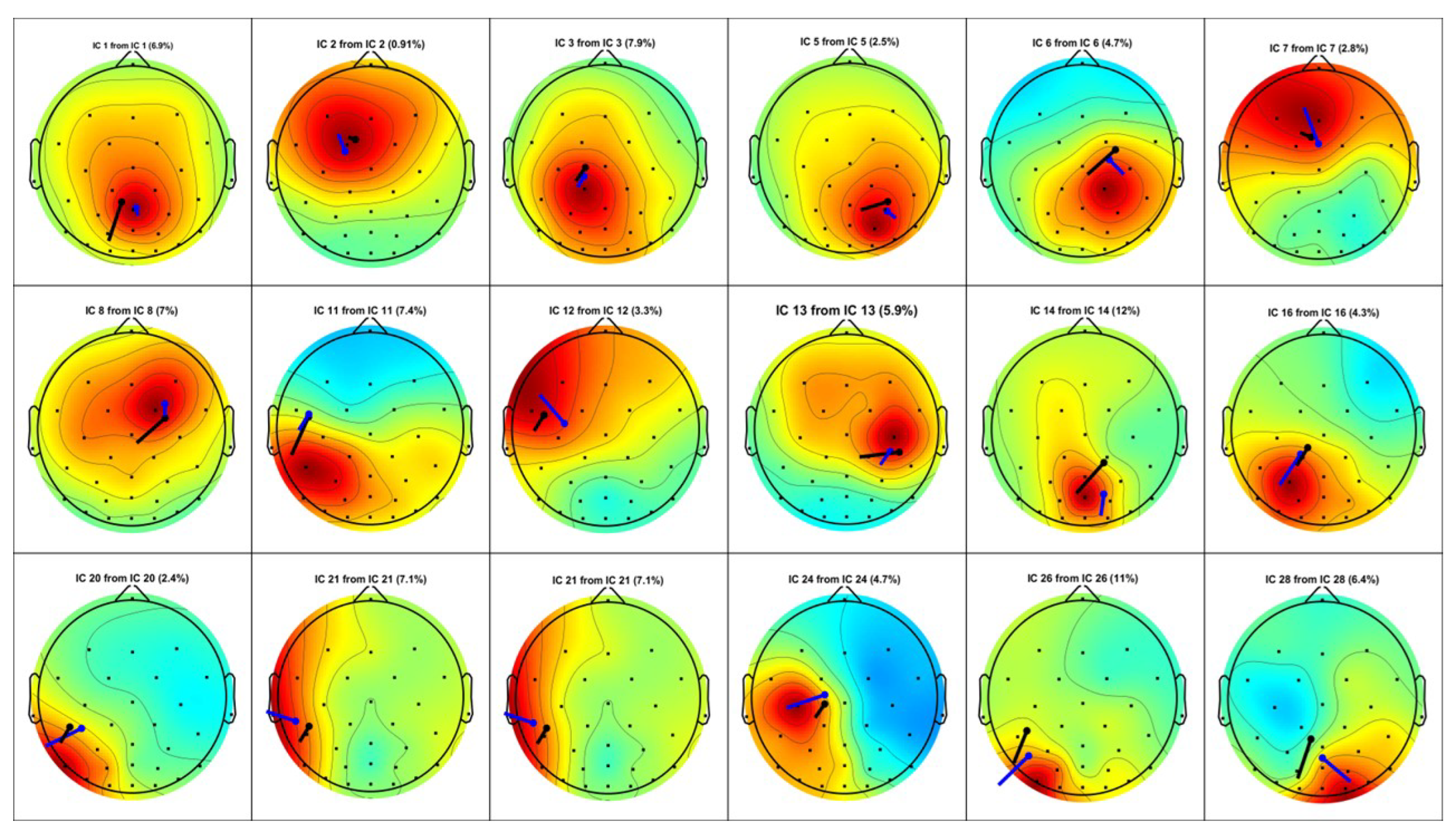 PDF) A test of brain electrical source analysis (BESA): A simulation study
