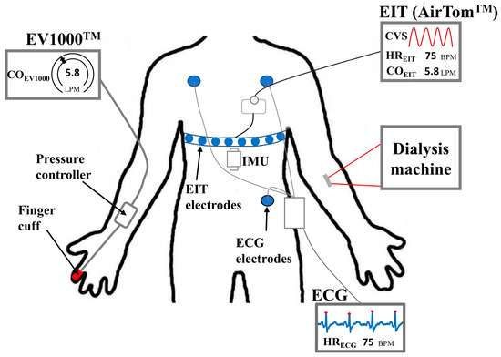 https://pub.mdpi-res.com/sensors/sensors-23-05308/article_deploy/html/images/sensors-23-05308-g001-550.jpg?1685772887