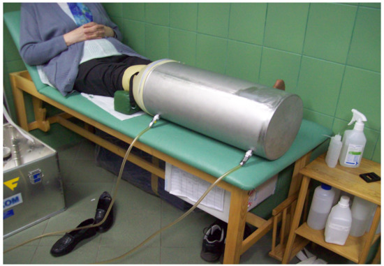 Sensors Free Full Text Application of Topical Hyperbaric Oxygen