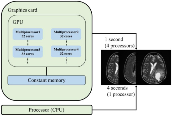 GPU-Based Parallel Processing Techniques for Enhanced Brain Magnetic ...