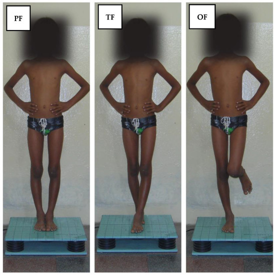 Sensors Free Full Text Postural Sway Velocity of Deaf Children  