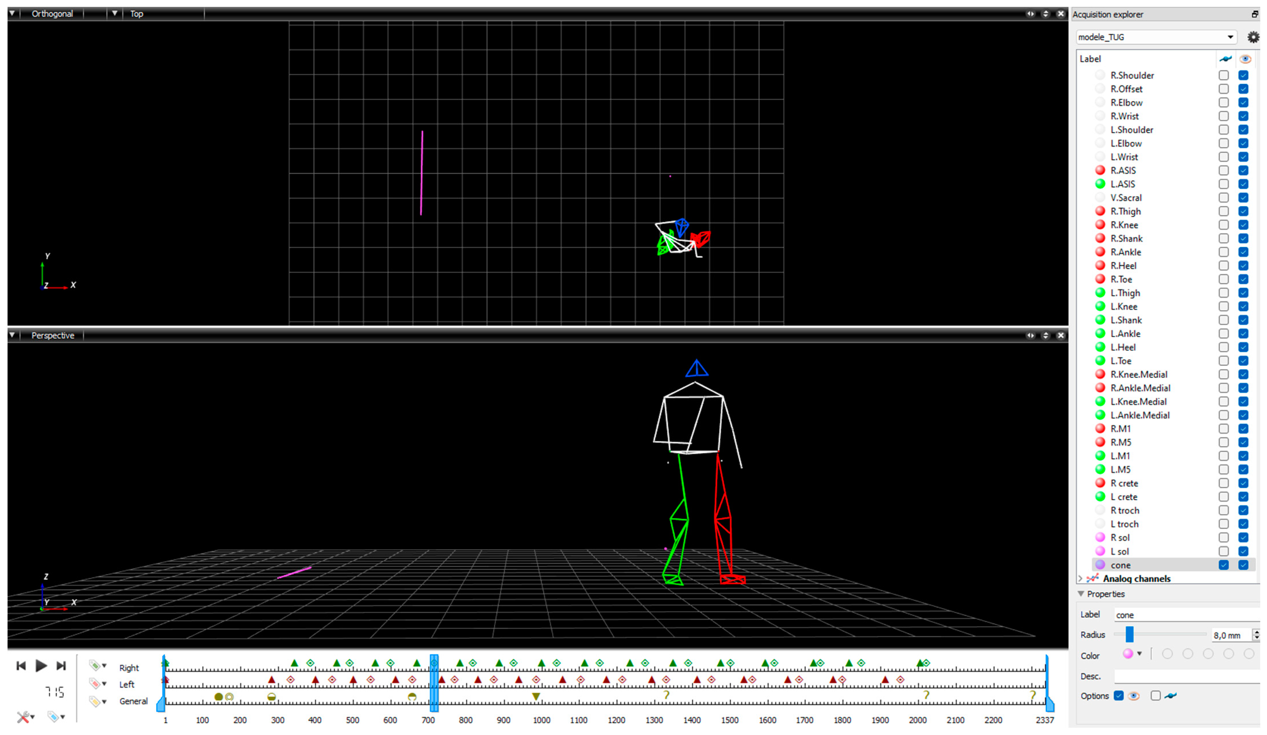 Sensors | Free Full-Text | Cautious Gait during Navigational Tasks in ...