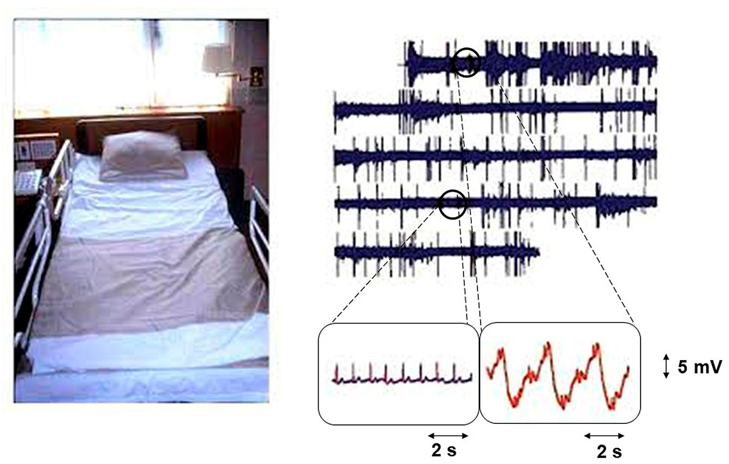 Unobtrusive Bed Monitor State of the Art