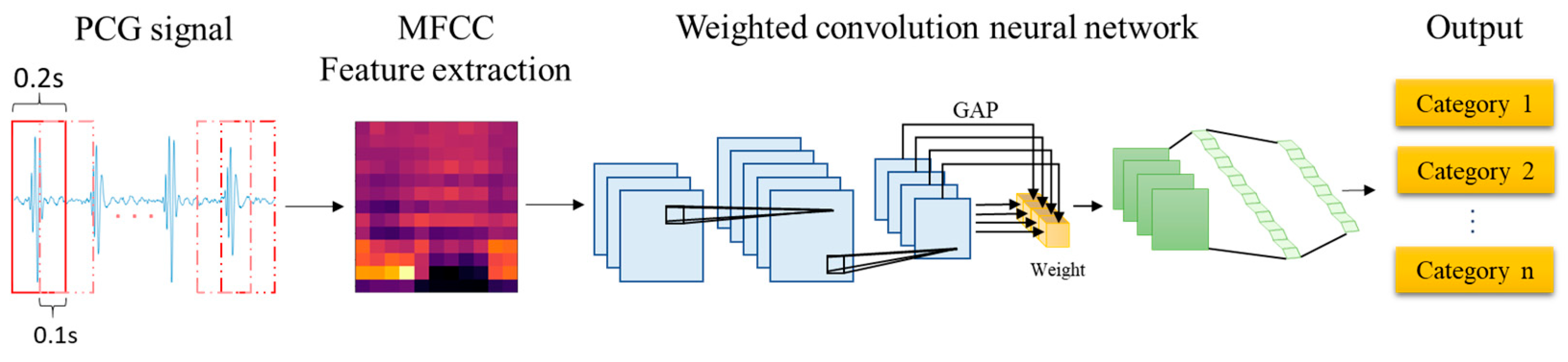 A Robust and Efficient Workflow for Heart Valve Disease Detection from ...