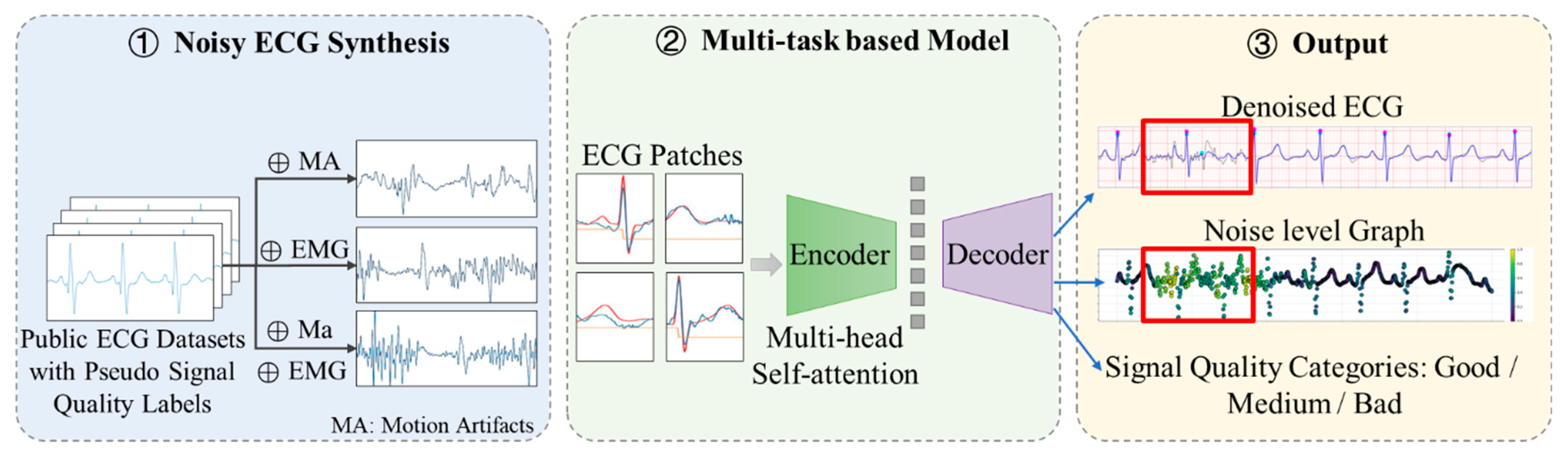 A Paralleled Multi-Task Learning-Based Framework for Single-Lead ECG ...