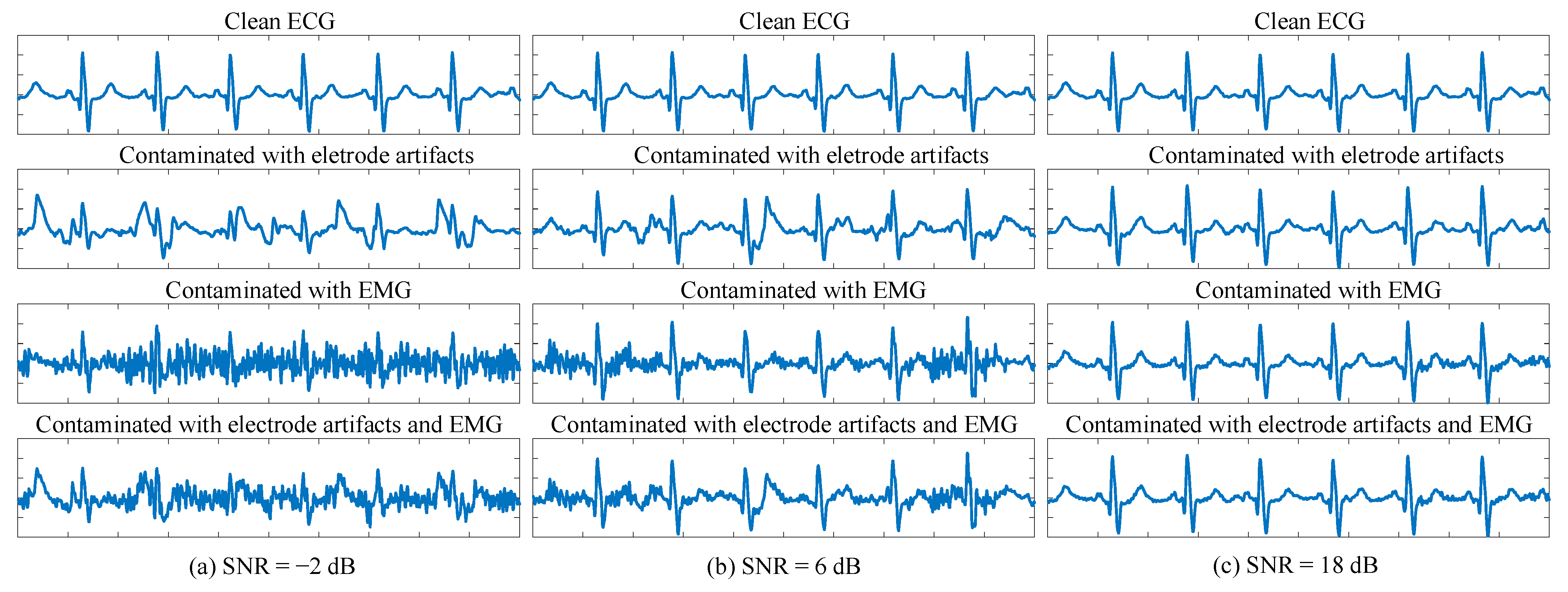 A Paralleled Multi-Task Learning-Based Framework for Single-Lead ECG ...