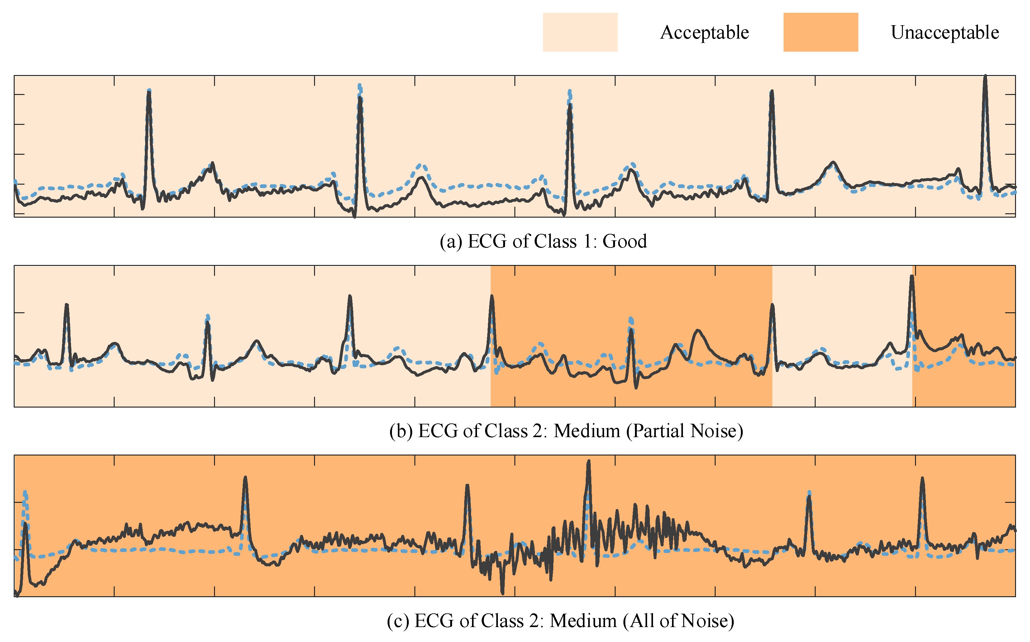 A Paralleled Multi-Task Learning-Based Framework for Single-Lead ECG ...