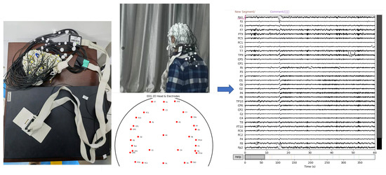 EEG Sensor-Based Parkinson’s Disease Detection Using a Multi-Domain ...