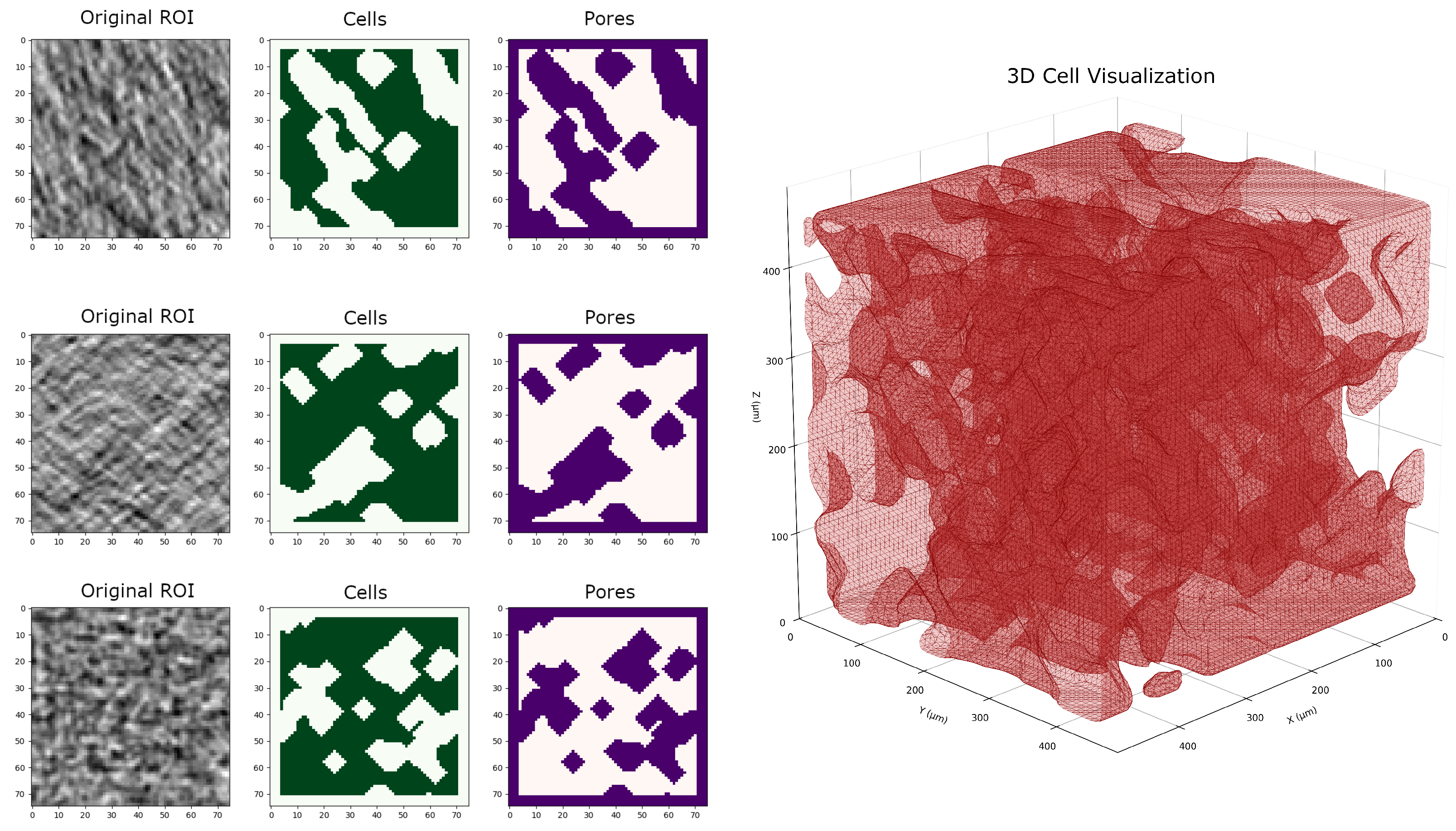 Ct Sensor Array Integration of X-Ray CT, Sensor Fusion, and Machine Learning for ...