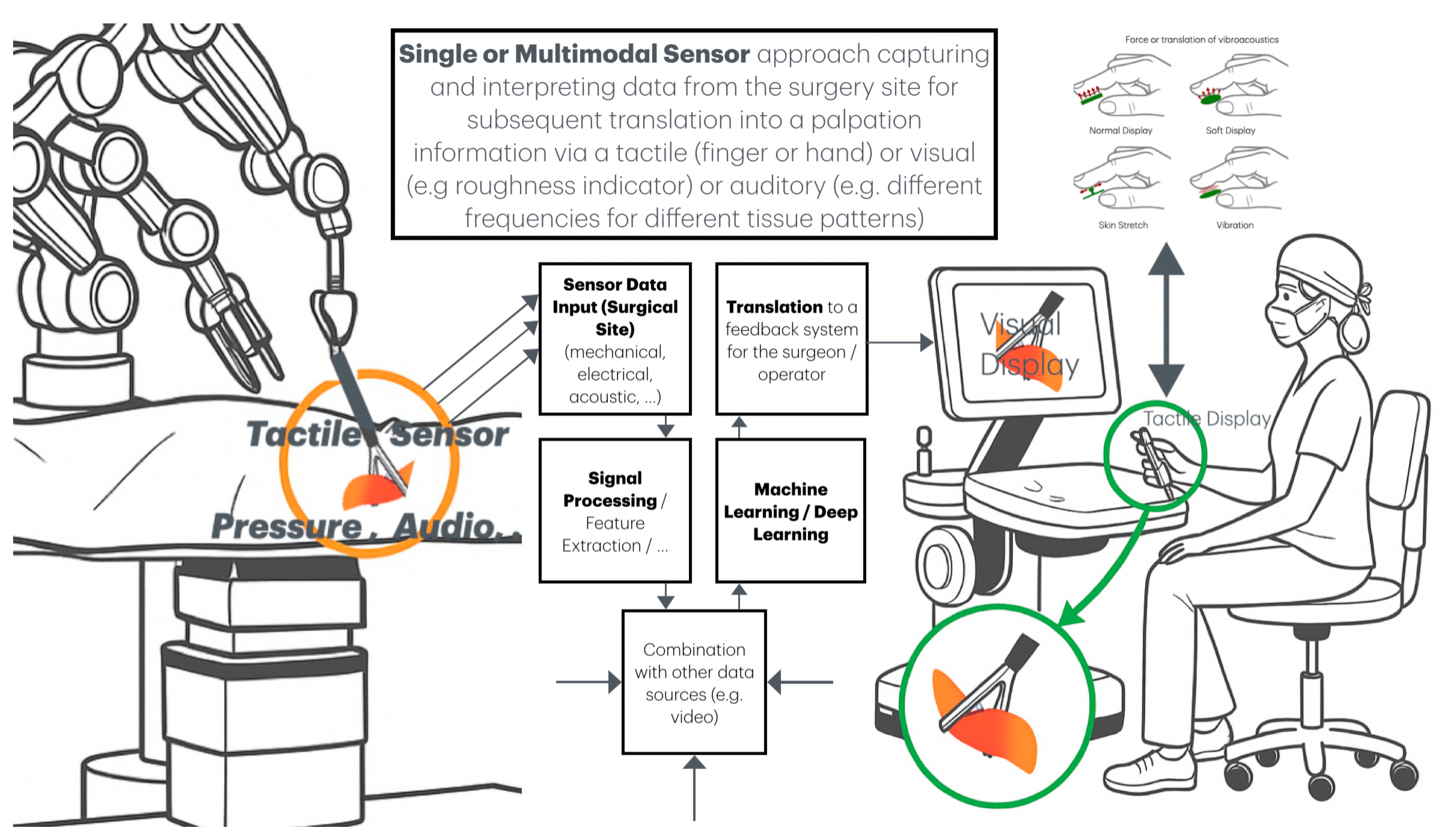 Haptic and Palpation Sensing for Robotic Surgery: Engineering ...