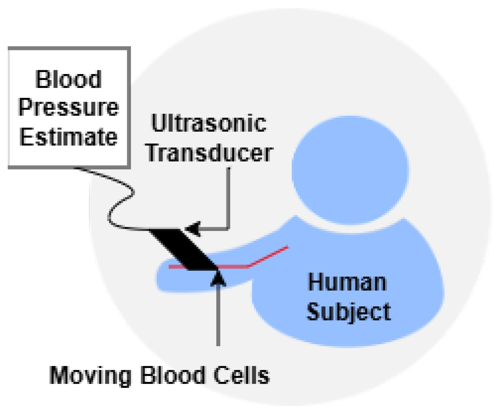 Beyond the Cuff: State-of-the-Art on Cuffless Blood Pressure Monitoring