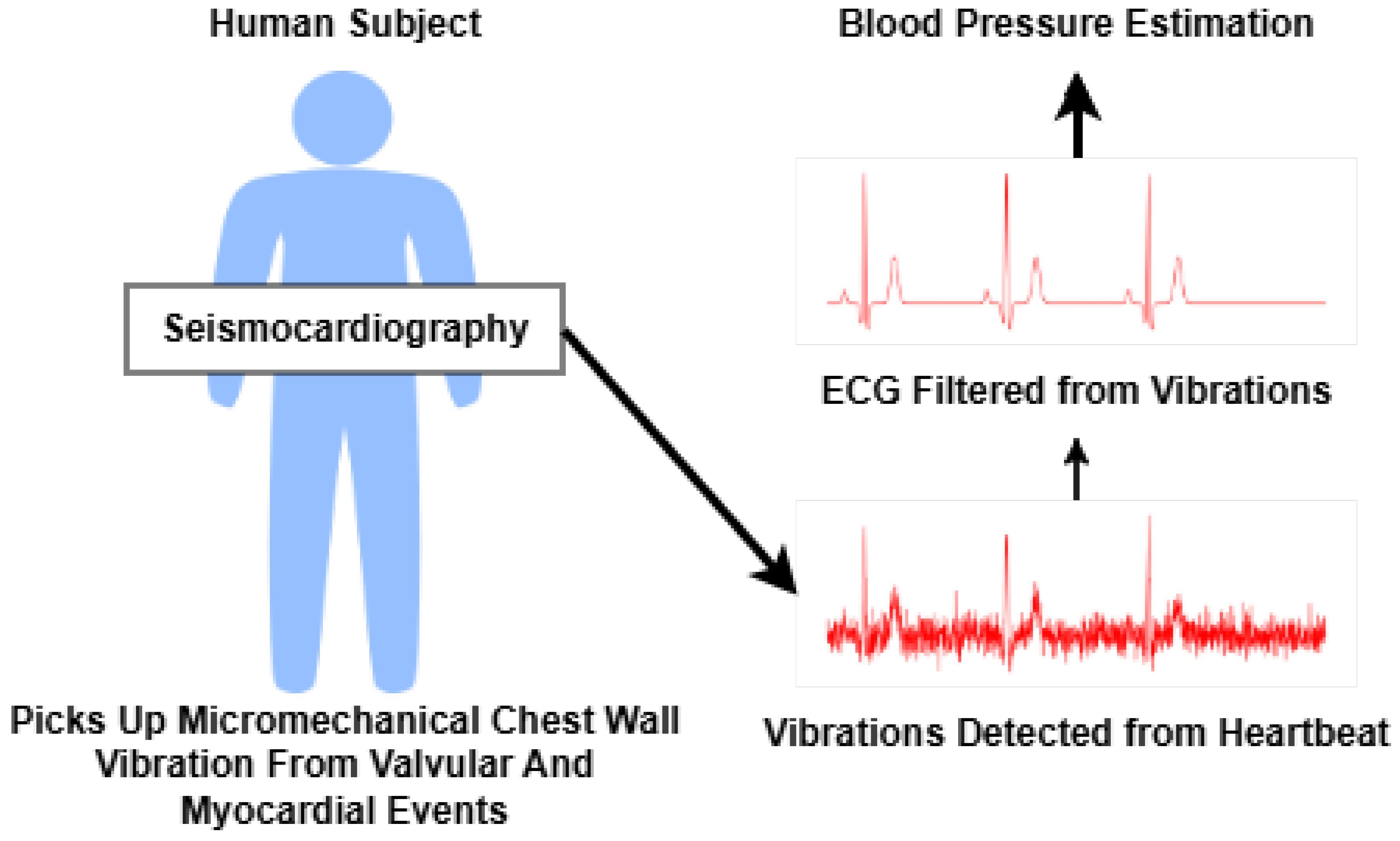 Beyond the Cuff: State-of-the-Art on Cuffless Blood Pressure Monitoring