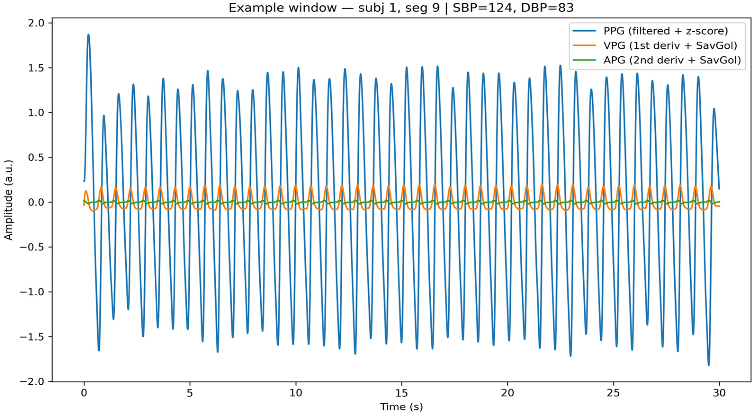 Peak-Independent Cuffless Blood Pressure Monitoring Using a Smart Sock ...
