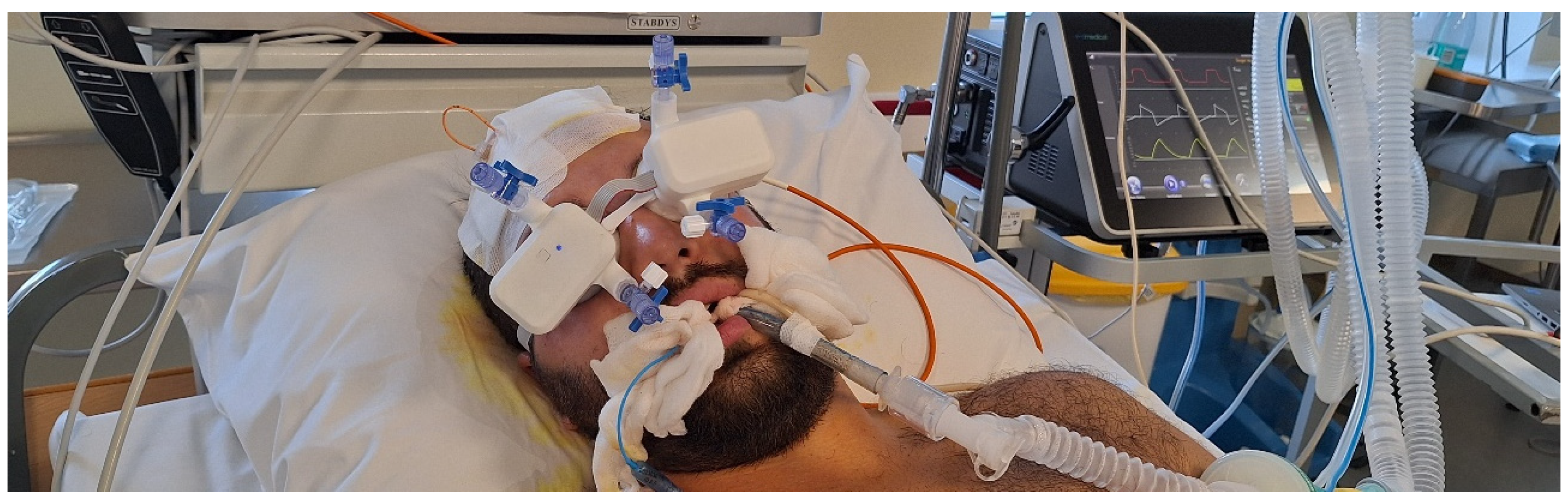 First-in-Human Prospective, Observational, and Comparative Clinical ...