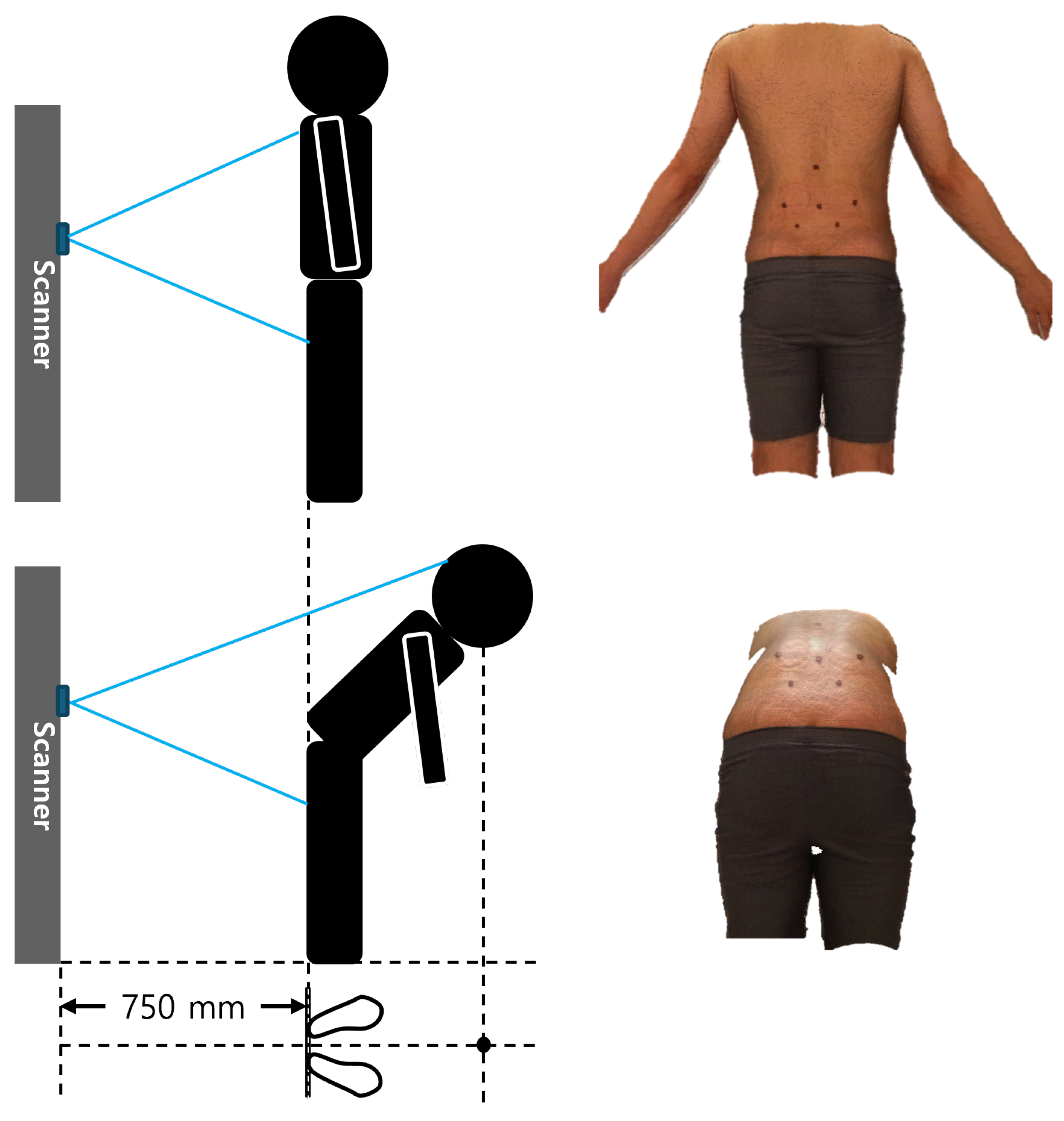 A Fully Automated Deep Learning Pipeline for Anatomical Landmark ...