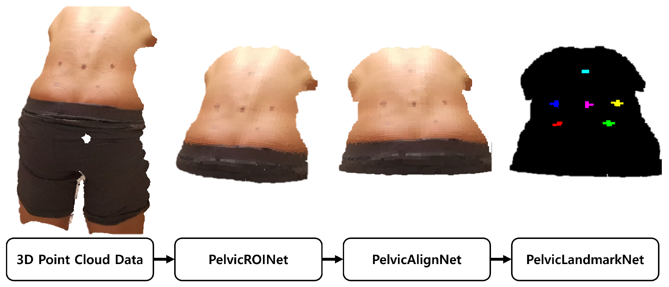 A Fully Automated Deep Learning Pipeline for Anatomical Landmark ...