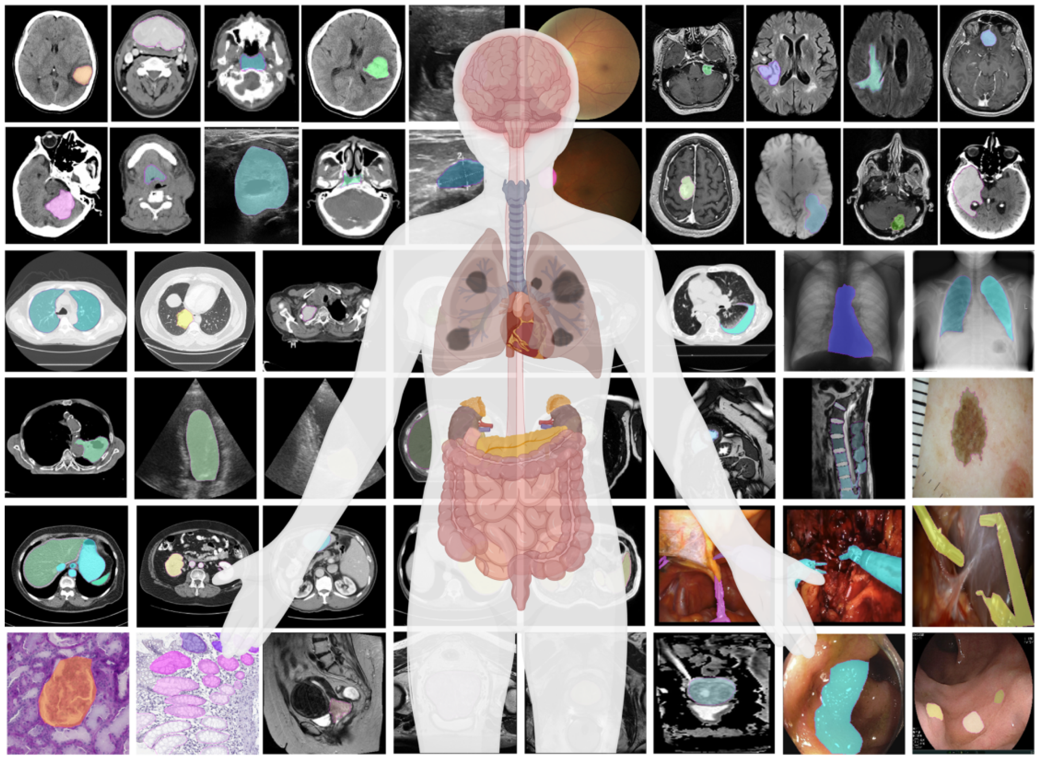 Efficient Medical Image Segmentation in Multisensor Imaging: A Survey ...