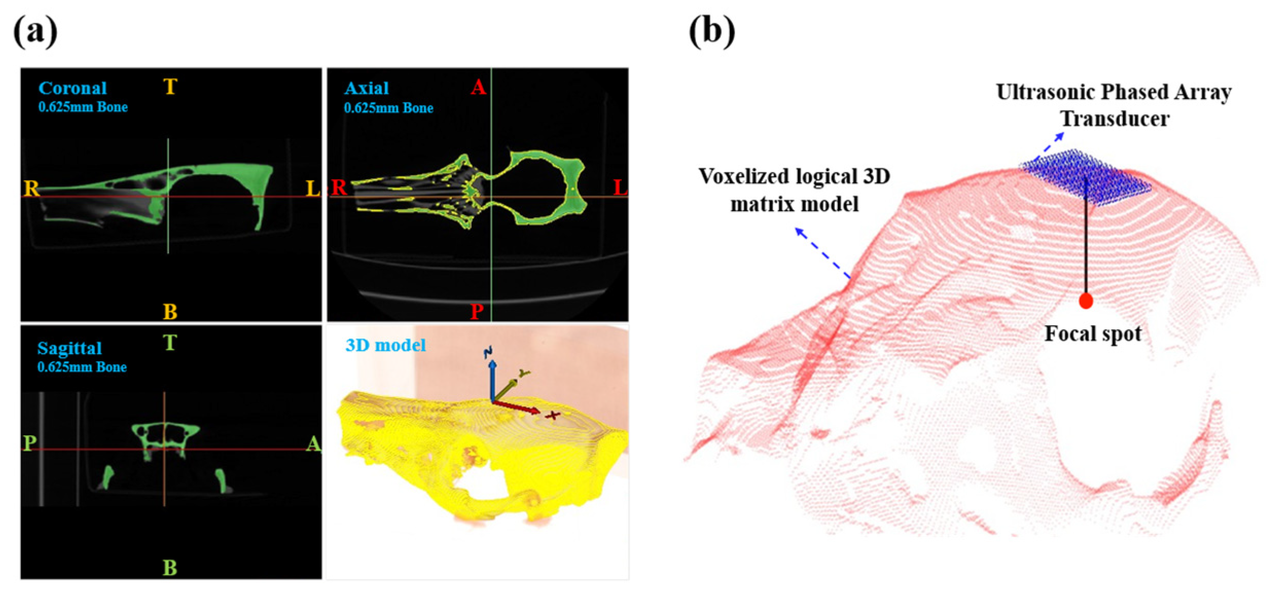 A Precise Focusing Simulation Platform for Transcranial Acoustoelectric ...