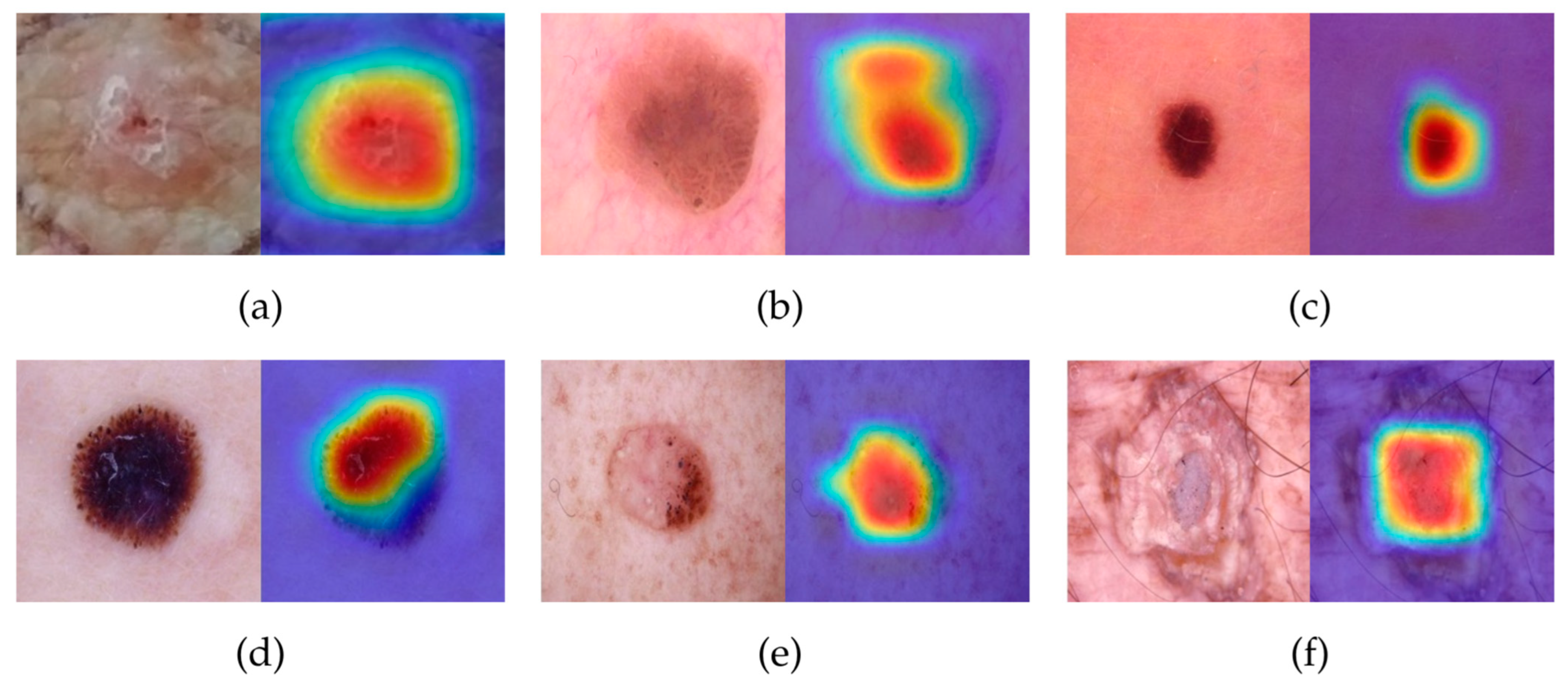 Hierarchical Deep Learning Framework for Skin Disease and Cancer ...