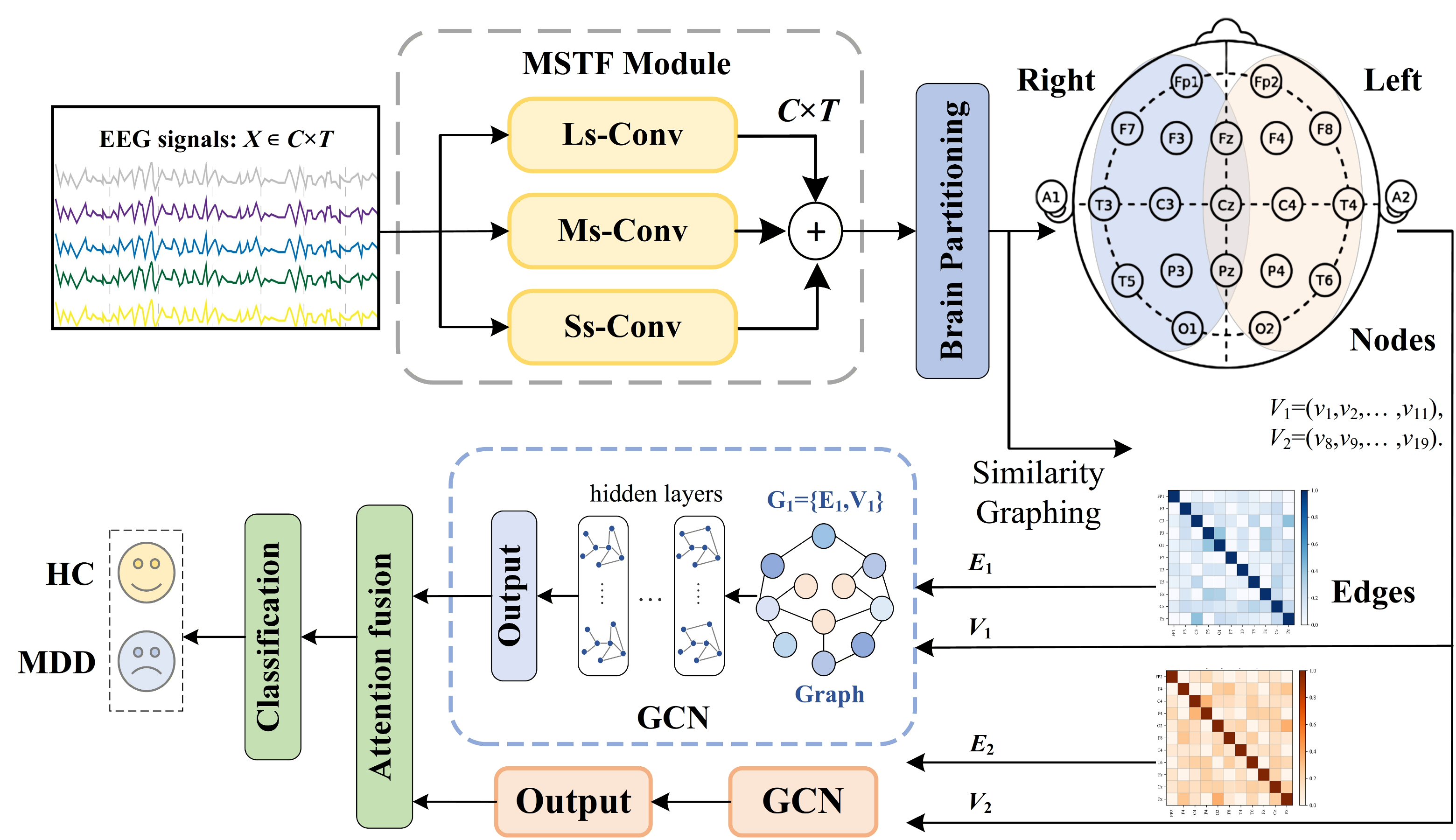 Multiscale Graph Network Memory Multi-Scale Spatiotemporal Graph Neural Network Using Brain ...