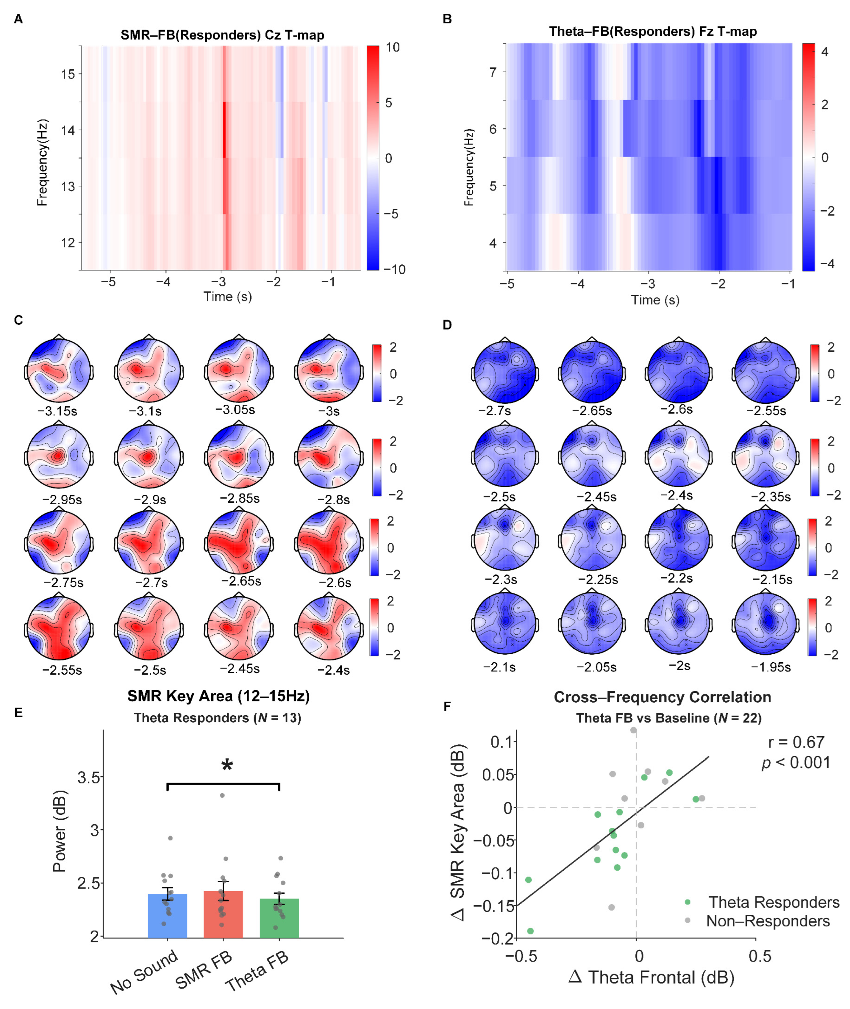 Design and Experimental Investigation of a Multi-Level Heartbeat Sound ...
