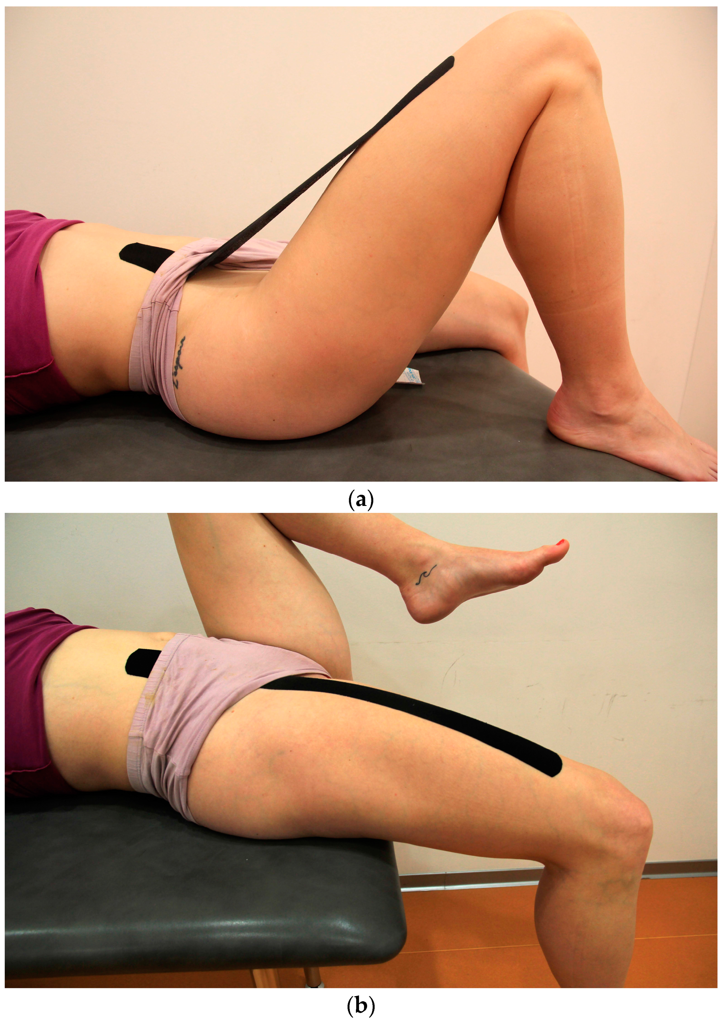 Sports Free Full-Text The Effects of Kinesio Tapingandreg; on Muscle Interplay within the Lumboandndash;Pelvicandndash;Hip Complex A Randomized Placebo-Controlled Trial