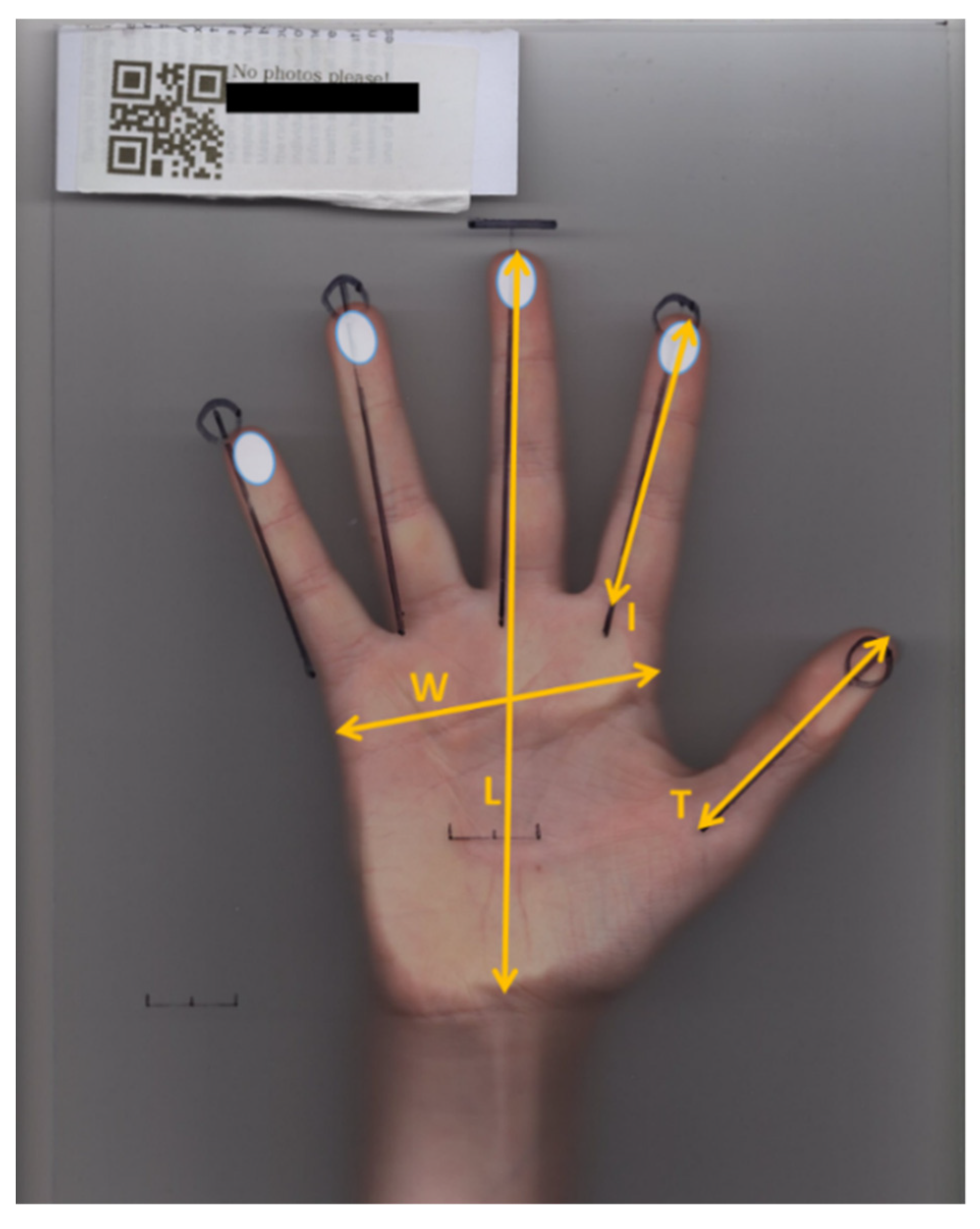 Symmetry Free Full-Text The Precision of the Human Hand Variability in Pinch Strength and Manual Dexterity