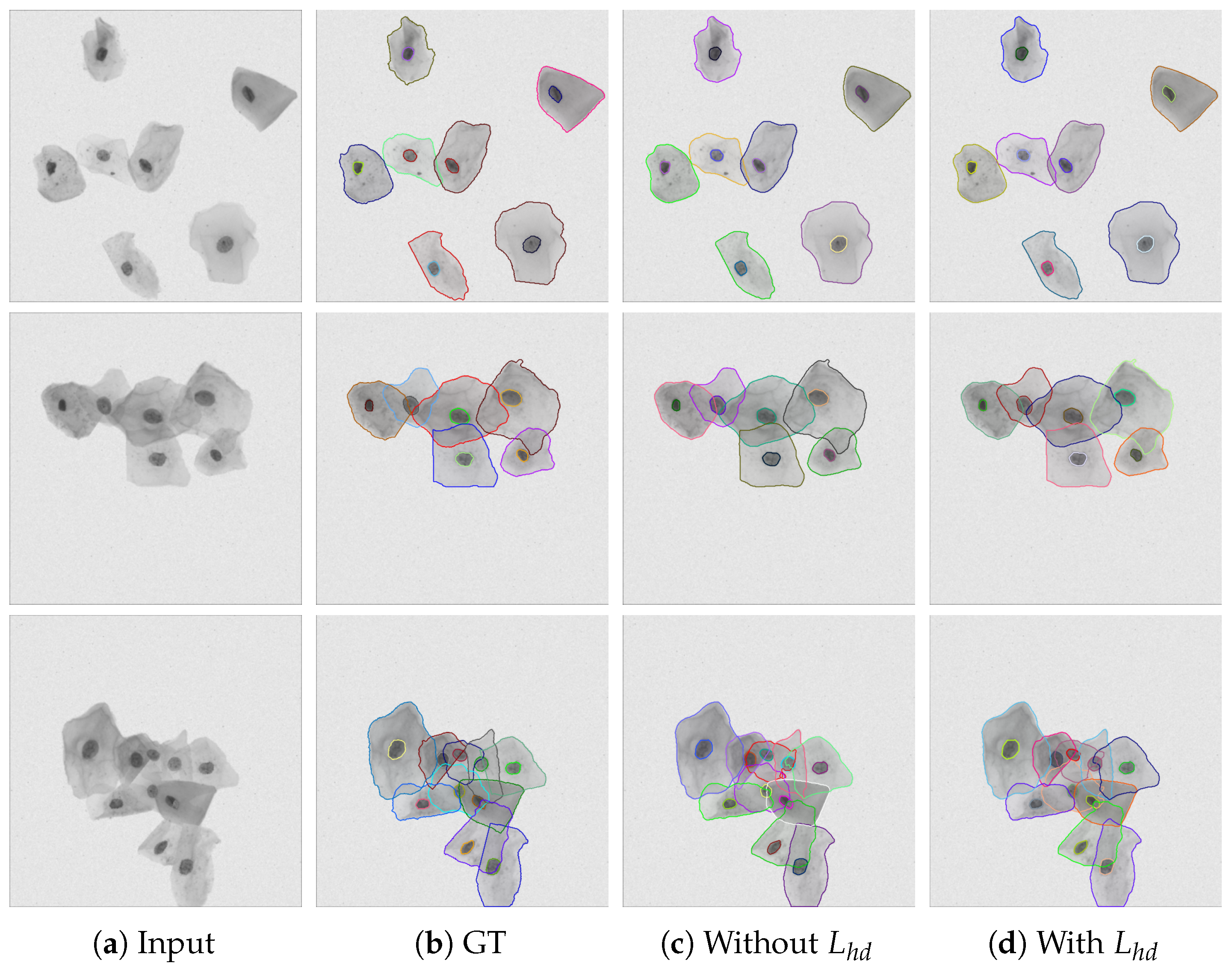 A Framework for Nuclei and Overlapping Cytoplasm Segmentation with ...