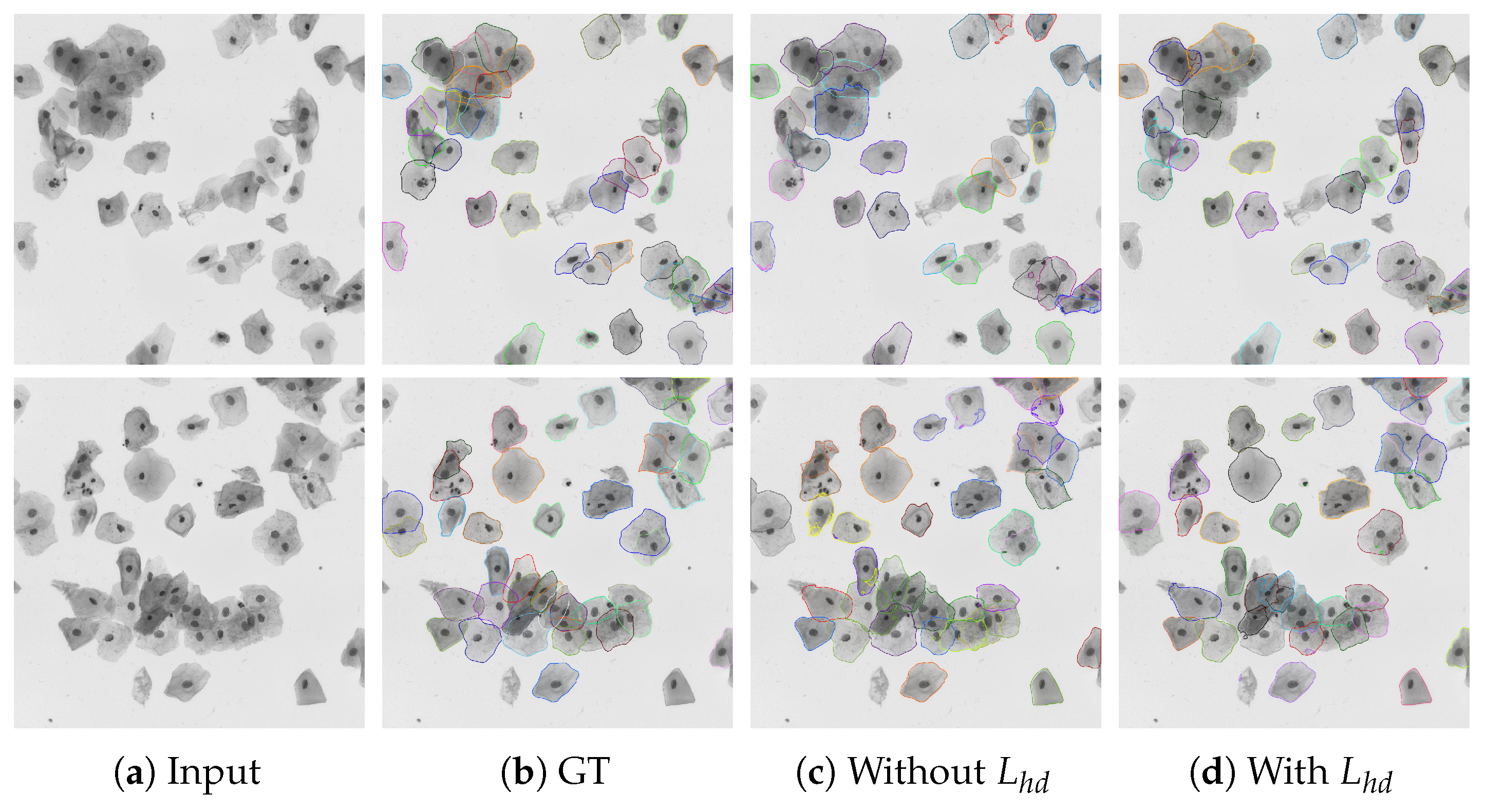 A Framework for Nuclei and Overlapping Cytoplasm Segmentation with ...