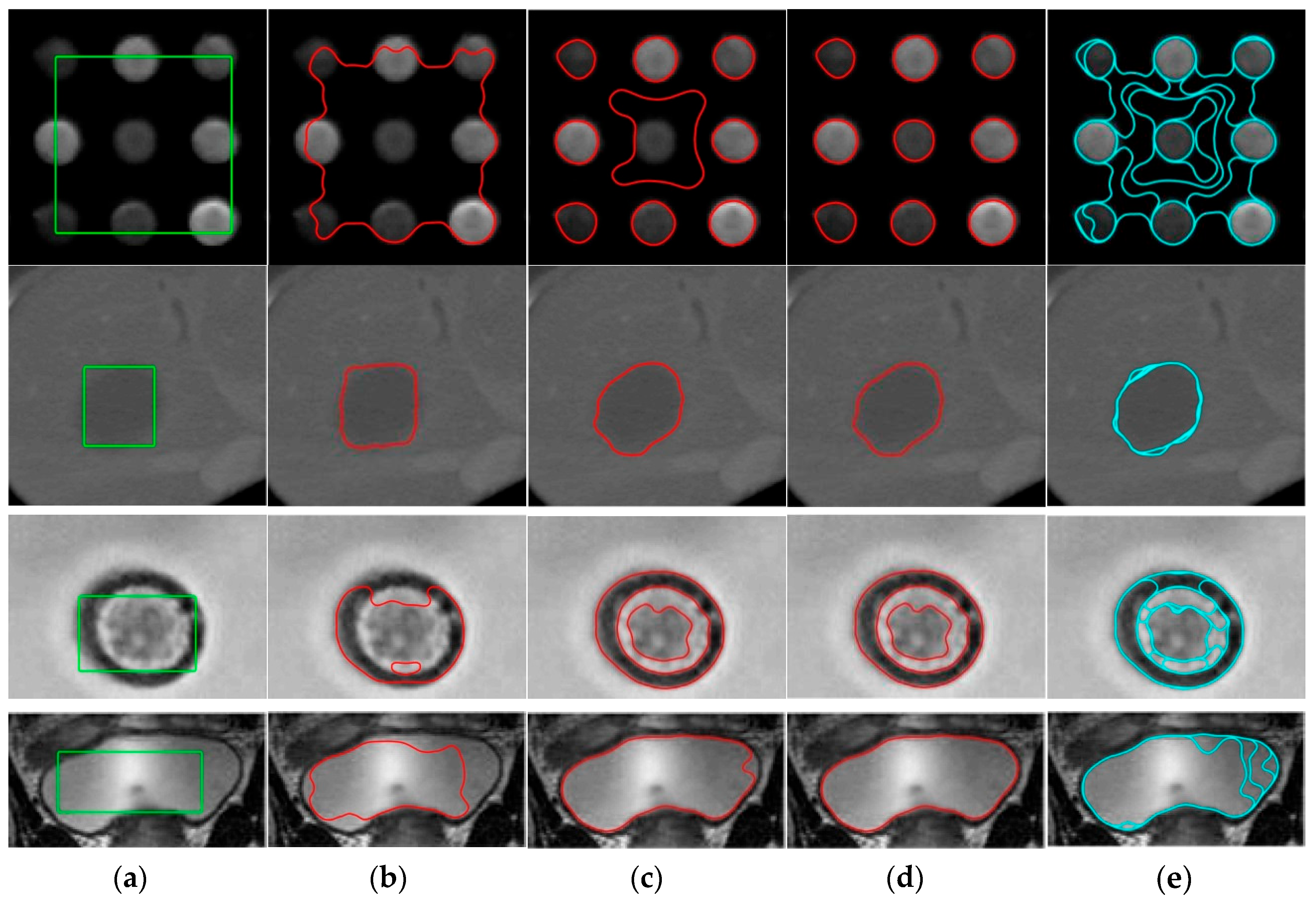 A Fast Image Segmentation Algorithm Based on Grayscale Morphological ...