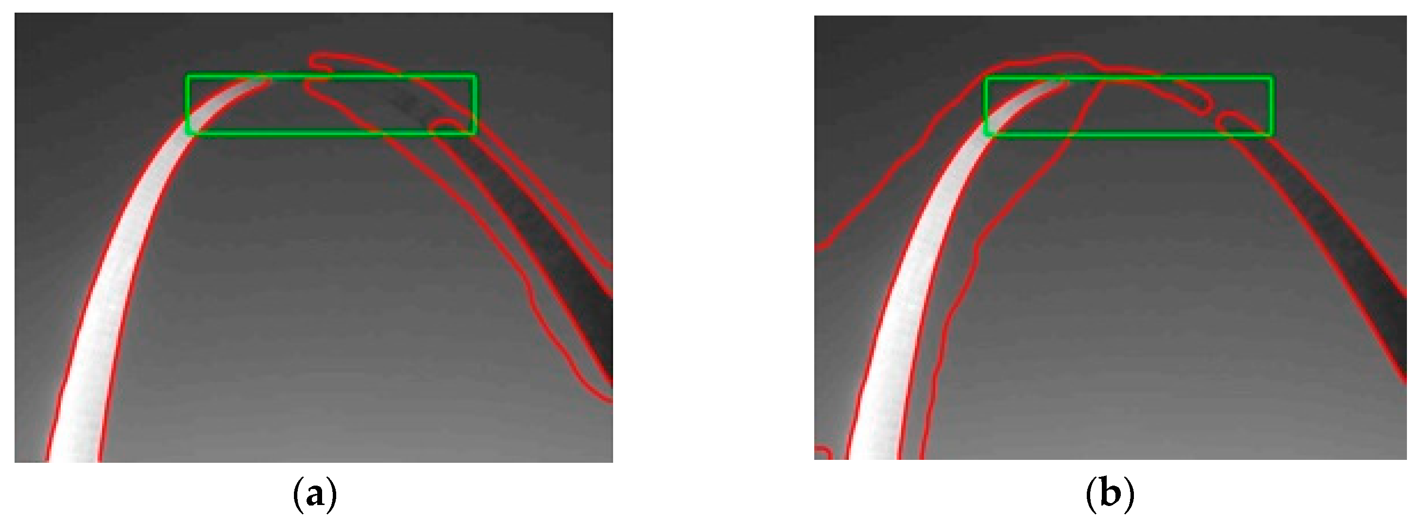 A Fast Image Segmentation Algorithm Based on Grayscale Morphological ...