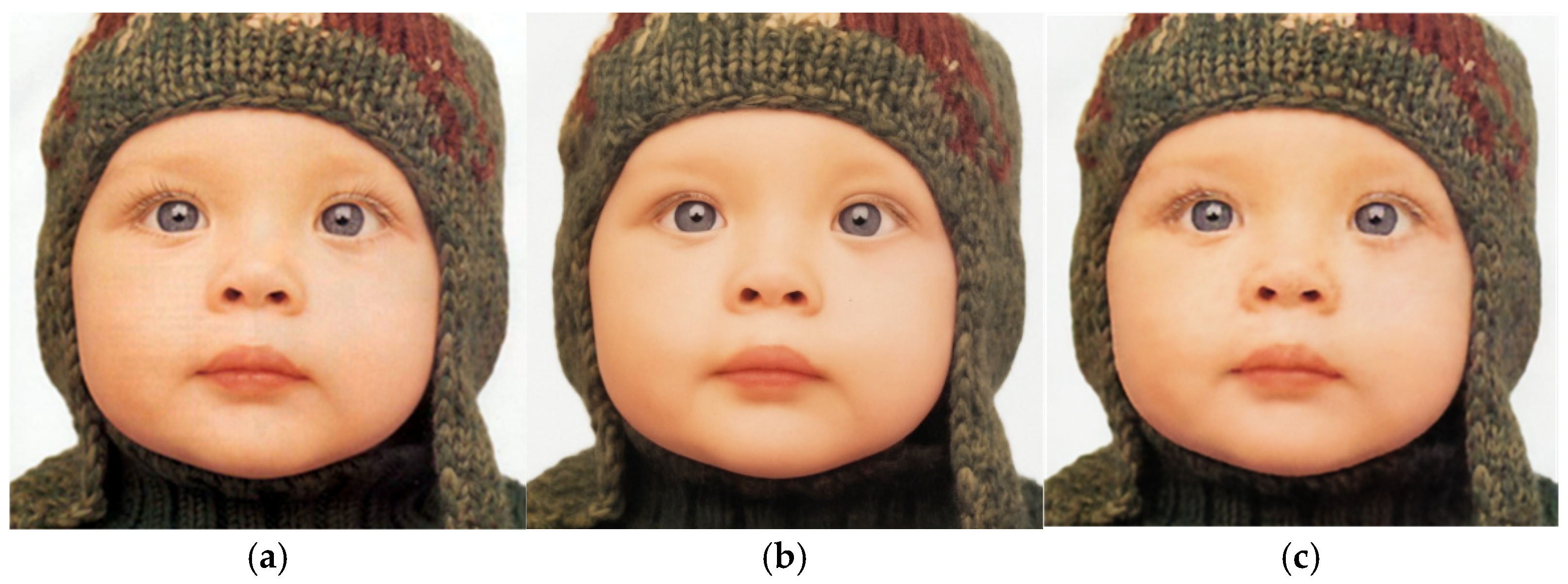 Anisotropic Total Generalized Variation Enhanced Deep Image Prior for ...