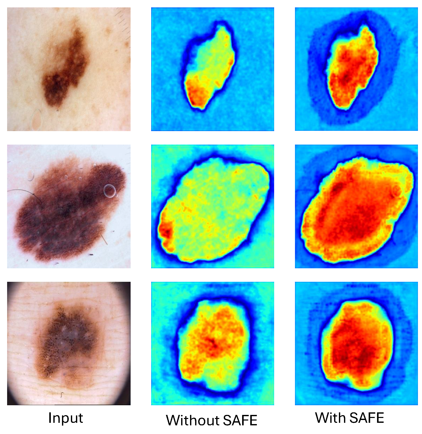 Enhancing Early Skin Cancer Detection: A Deep Learning Approach with ...