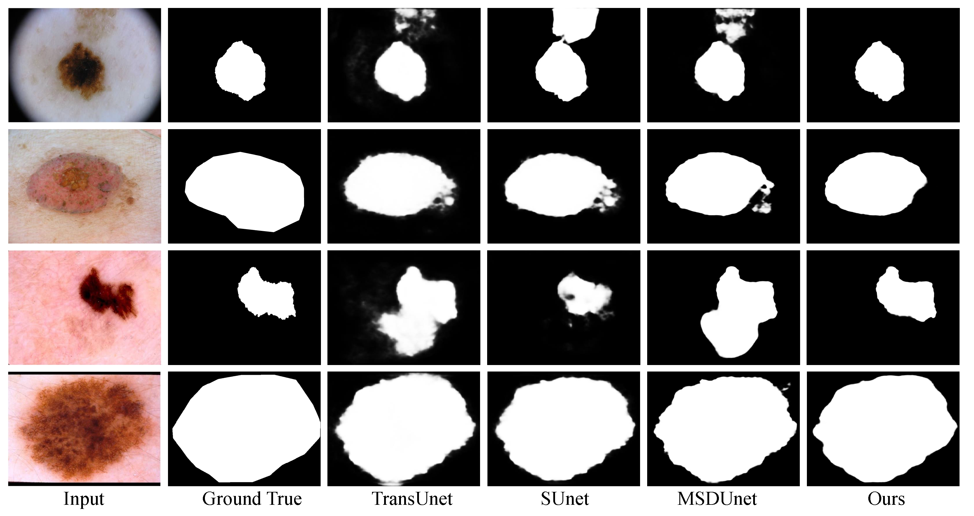 Enhancing Early Skin Cancer Detection: A Deep Learning Approach with ...