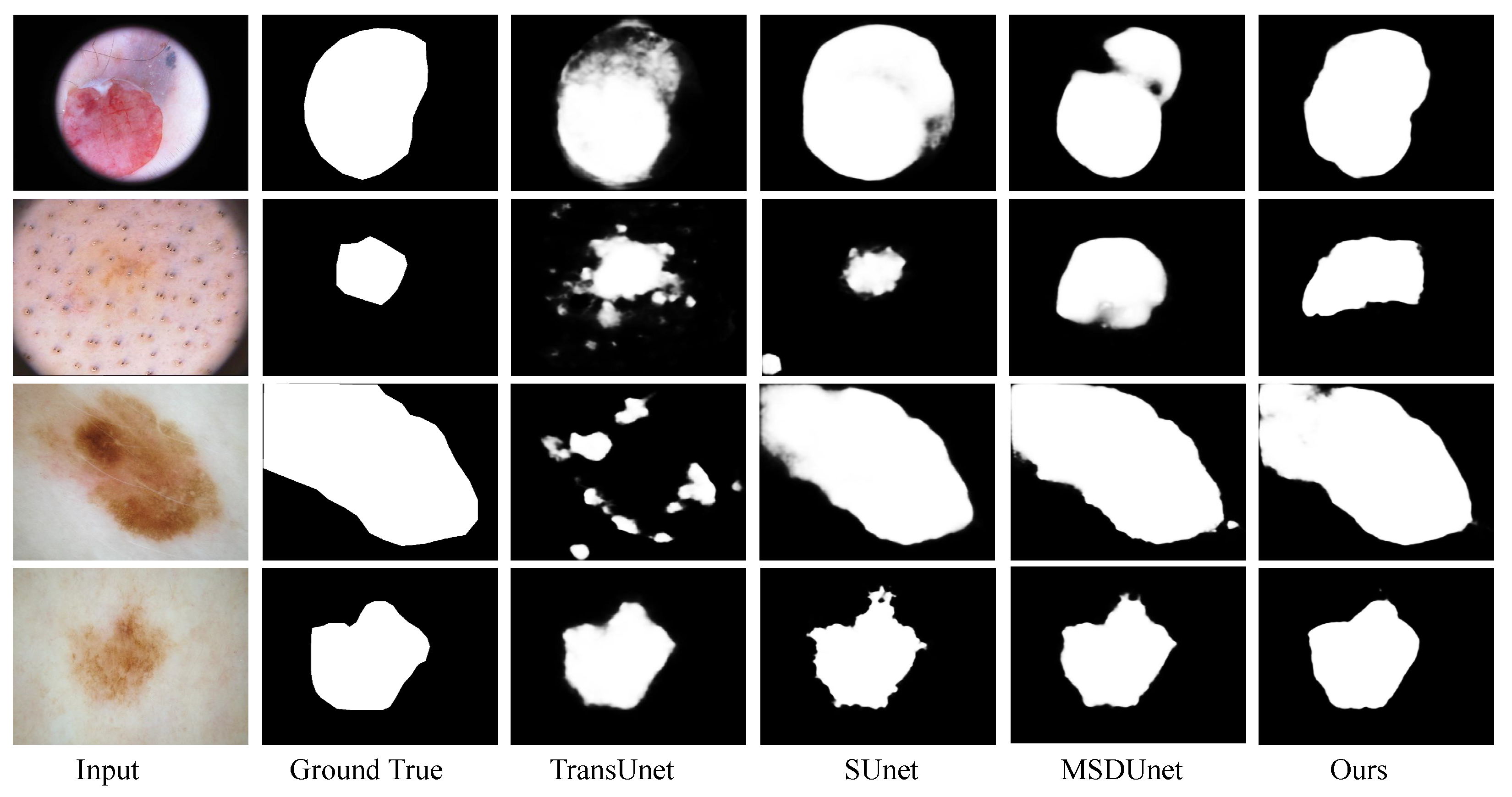 Enhancing Early Skin Cancer Detection: A Deep Learning Approach with ...