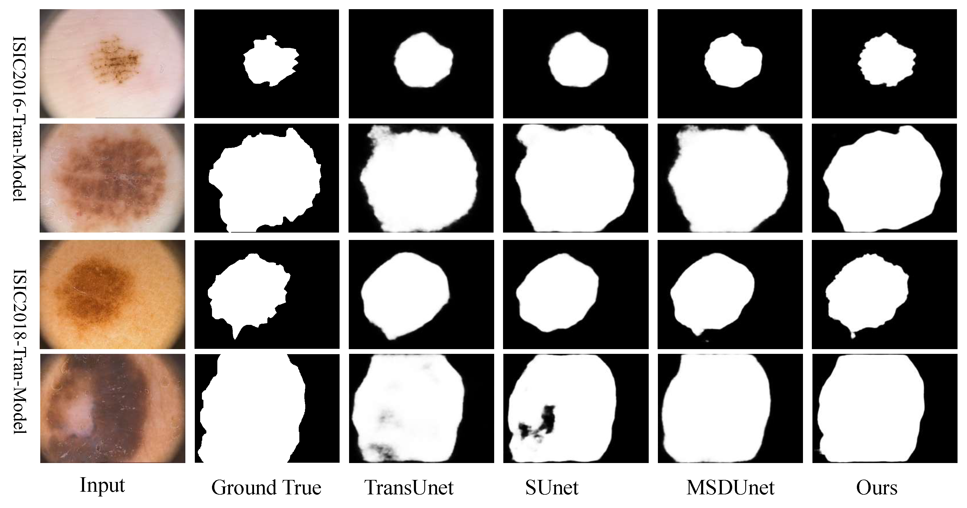 Enhancing Early Skin Cancer Detection: A Deep Learning Approach with ...