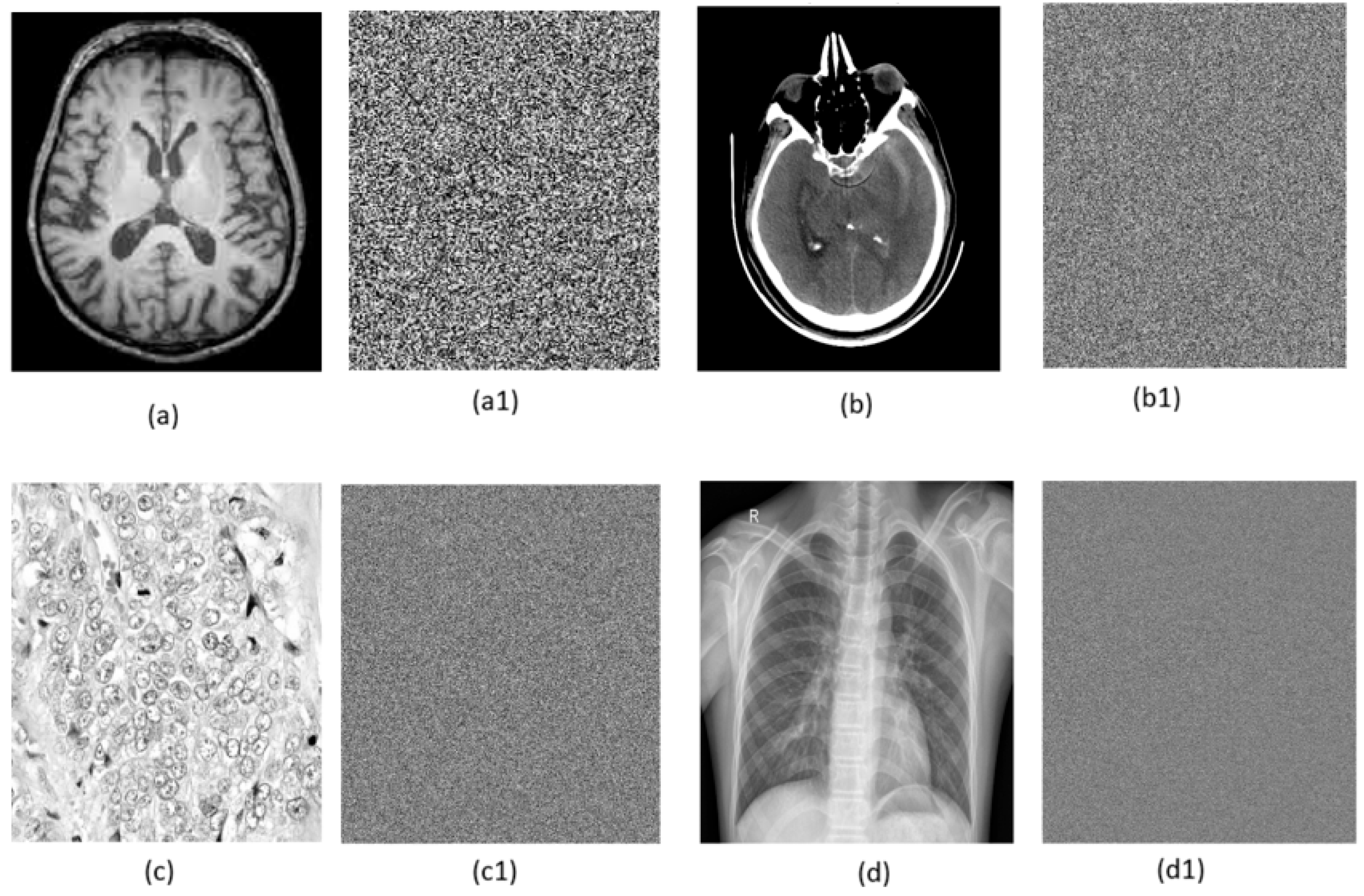 Secure Medical Image Encryption System Using Optimal Key-Based Elliptic ...