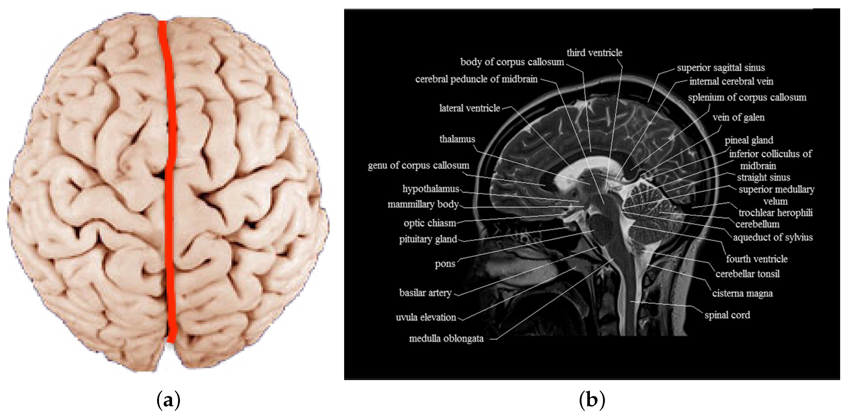 ventral view of brain diagram