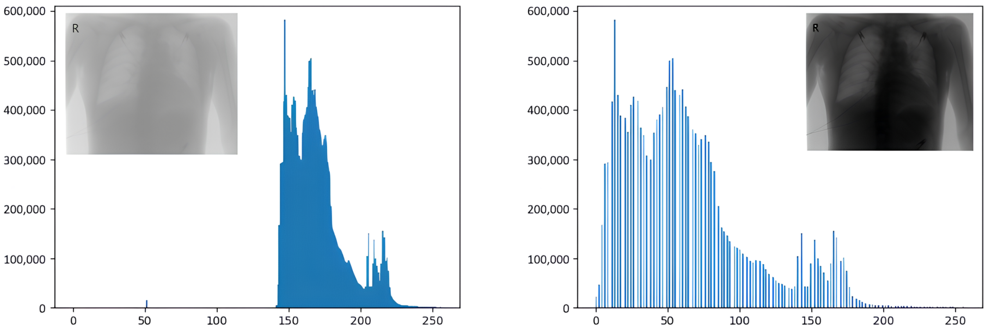 Lung Disease Classification Using Deep Learning and ROI-Based Chest X ...