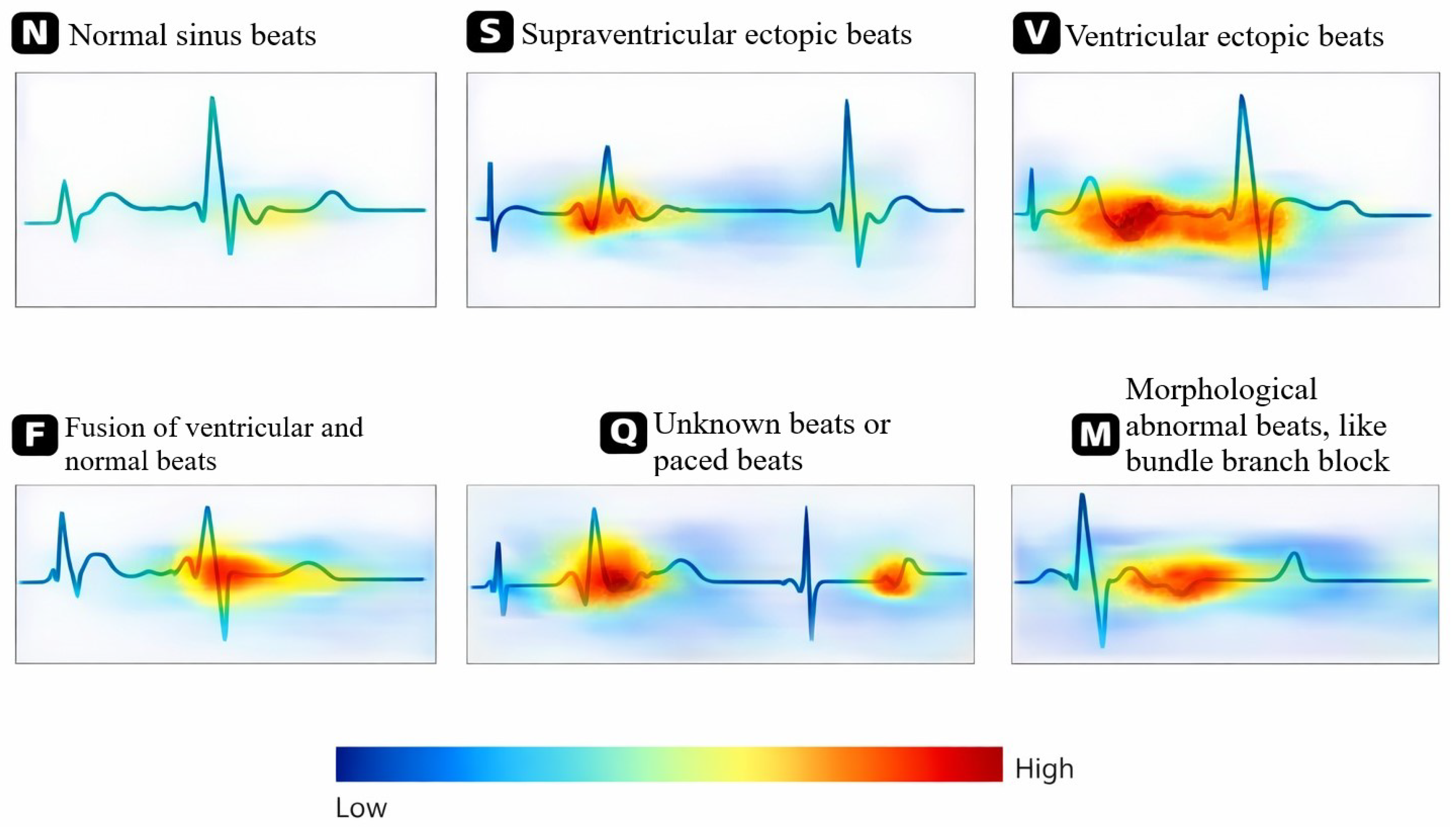 RhythmX™: An Interpretable Self-Supervised Contrastive Learning ...