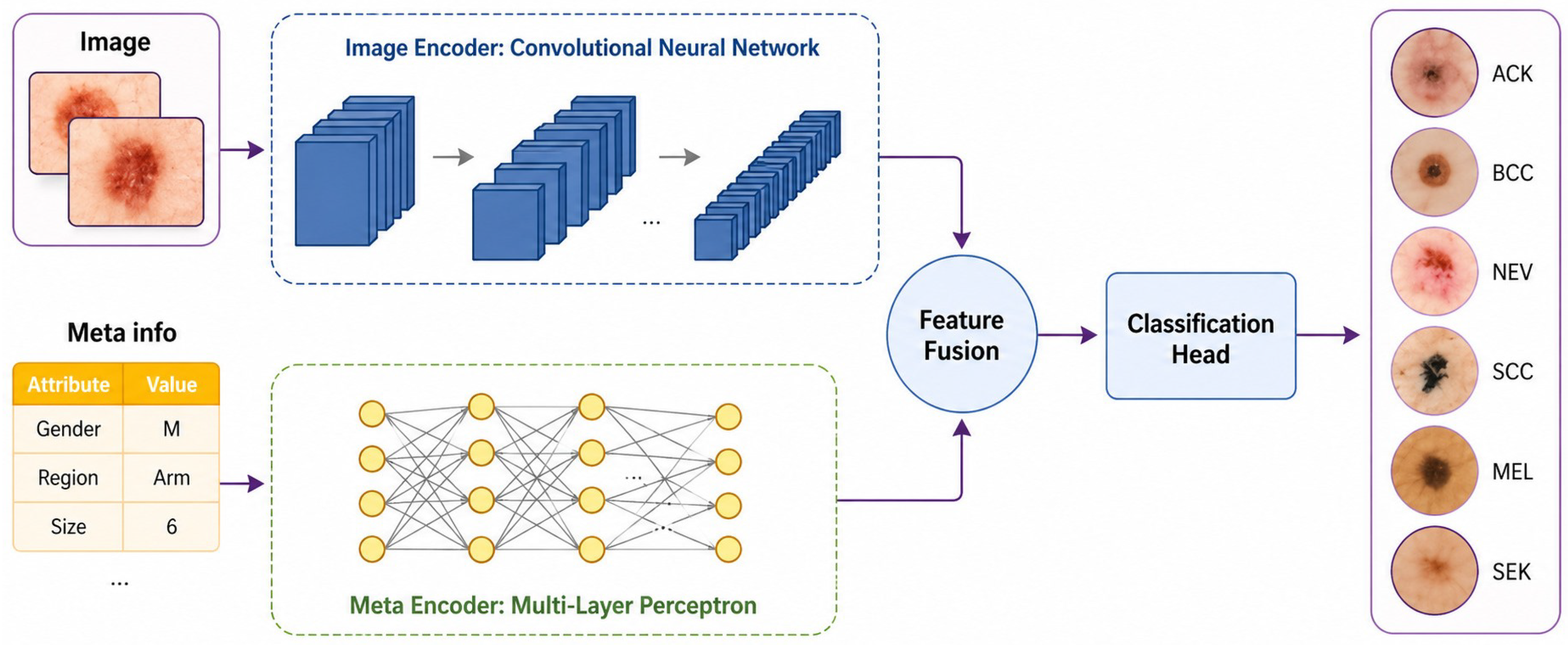Ensemble-Based Multimodal Deep Learning for Precise Skin Cancer ...