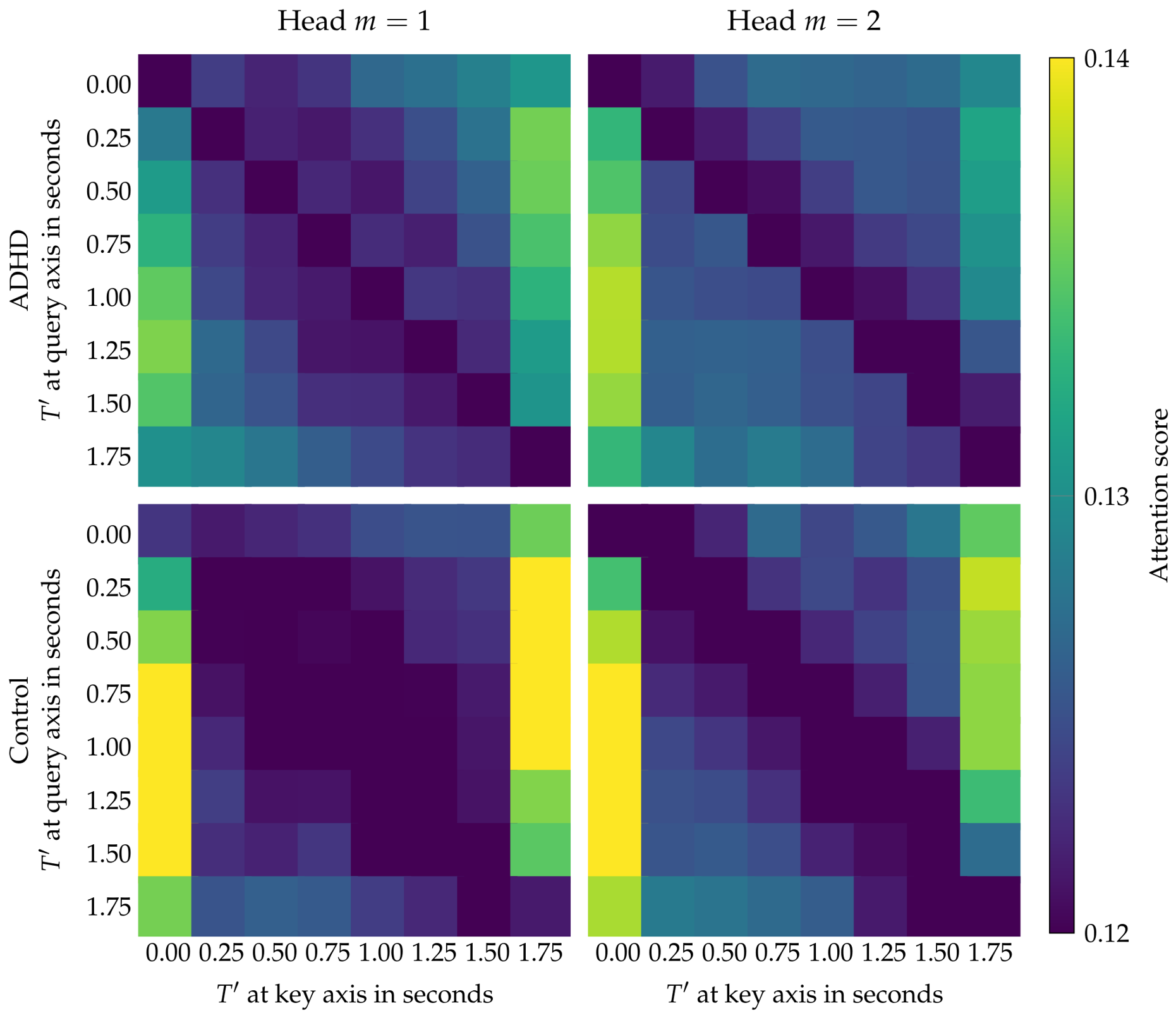 Temporal Attention and Convolutional Tokenization for Interpretable EEG ...