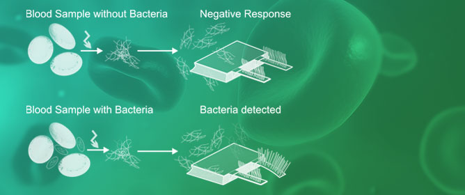 Rapid Bacteria Detection from Patients&rsquo; Blood Bypassing Classical Bacterial Culturing