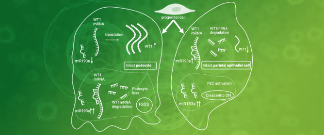 Parietal Epithelial Cell Behavior and Its Modulation by microRNA-193a