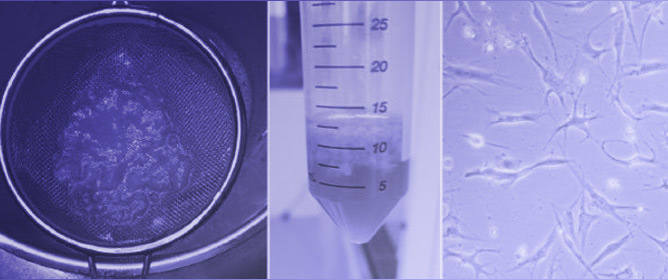 Isolation and Cultivation of Adipose-Derived Mesenchymal Stem Cells Originating from the Infrapatellar Fat Pad Differentiated with Blood Products: Method and Protocol