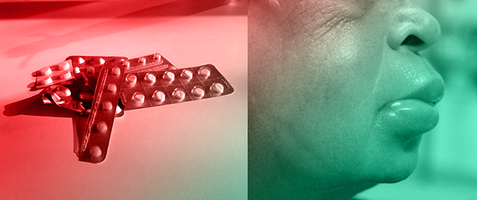 Bradykinin-Mediated Angioedema Induced by Commonly Used Cardiovascular Drugs