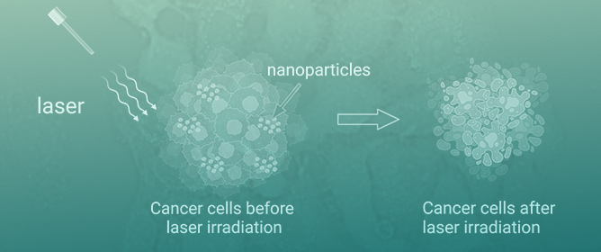 Photodynamic Treatment of Cancer Cells with Encapsulated Rose Bengal