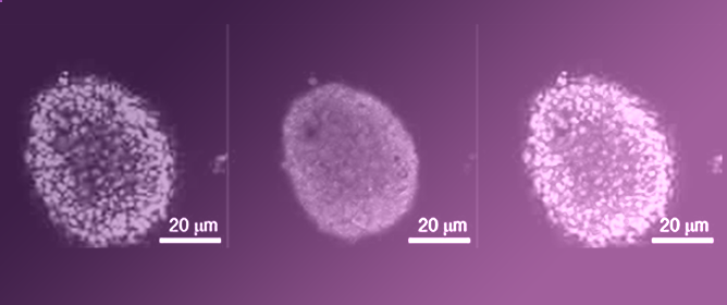Elucidating Novel Targets for Ovarian Cancer Antibody&ndash;Drug Conjugate Development: Integrating In Silico Prediction and Surface Plasmon Resonance to Identify Targets with Enhanced Antibody Internalization Capacity
