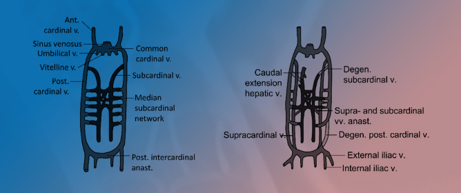 Unique Constellation of Vascular Anomalies in a Female Cadaver: IVC, Renal Vein, and Left Colic Artery Variation