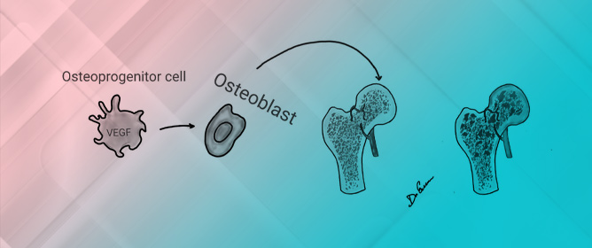 Conservative Treatment in Avascular Necrosis of the Femoral Head